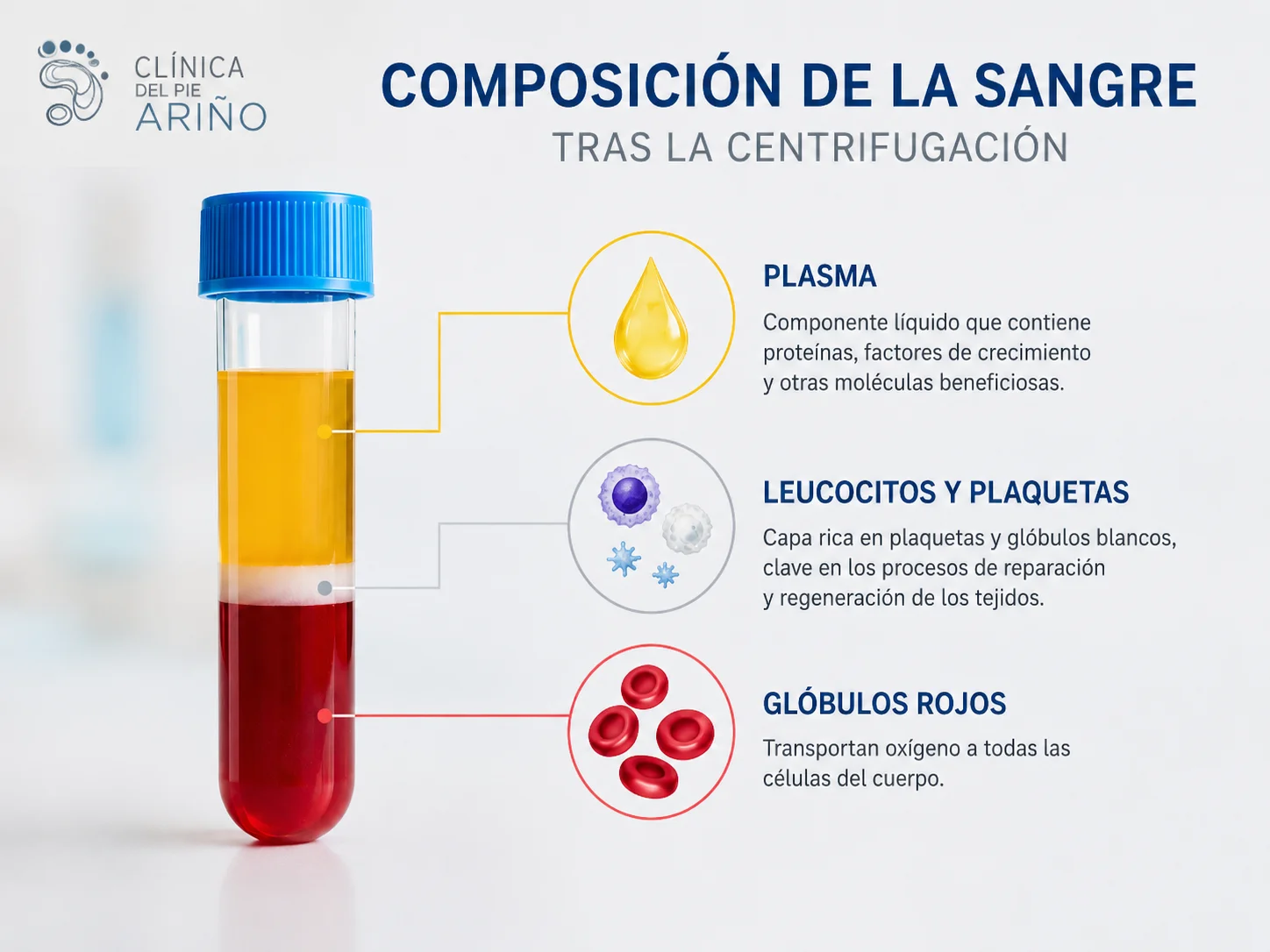 Infografía sobre la composición de la sangre y el plasma rico en plaquetas