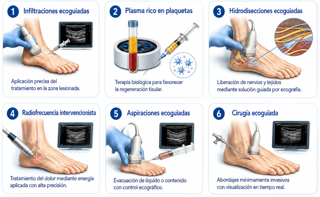 Infografía sobre procedimientos ecoguiados del pie